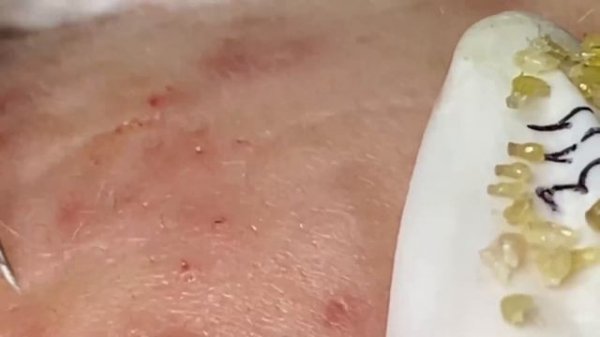 Enjoy Every Day With The Best Video Loan Nguyen Spa Official  2657