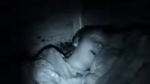 Sleep Apnoea in children - child stops breathing