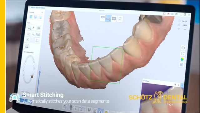 Der Medit i700 Intraoral-Scanner by Schütz Dental смотреть онлайн