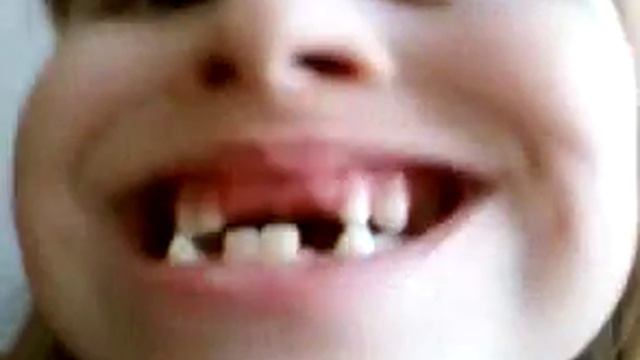Ай да зубы!!! смотреть онлайн