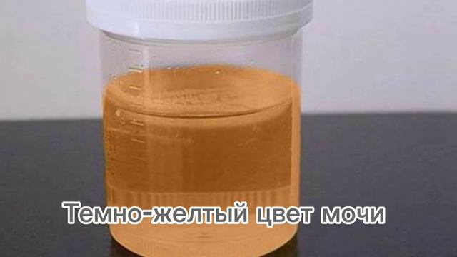 Не игнорируйте цвет мочи.Врачи предупреждают. смотреть онлайн