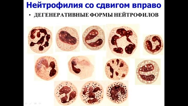 Лекция 1. Стомфак. Вводная и лейкоцитозы. смотреть онлайн