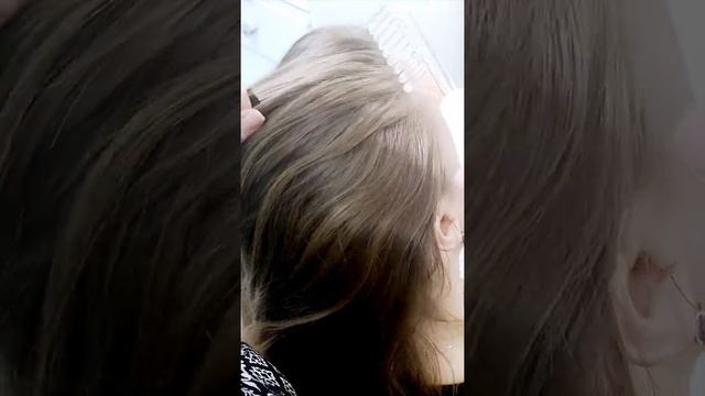 Стимуляция роста волос смотреть онлайн