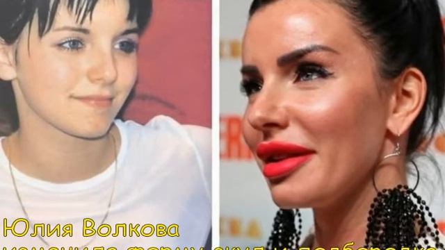 Красота страшная сила Российские звезды до и после пластики смотреть онлайн