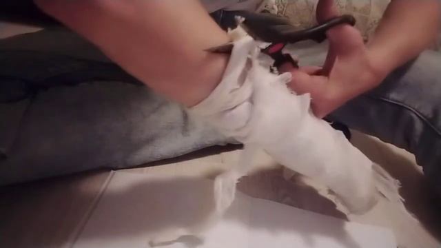 СНИМАЮ ГИПС С РУКИ смотреть онлайн