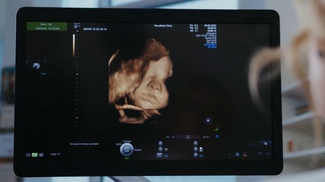 ПИТАНИЕ ПРИ БЕРЕМЕННОСТИ | 9 советов по питанию чтобы малыш родился здоровым а мама не голодала смотреть онлайн