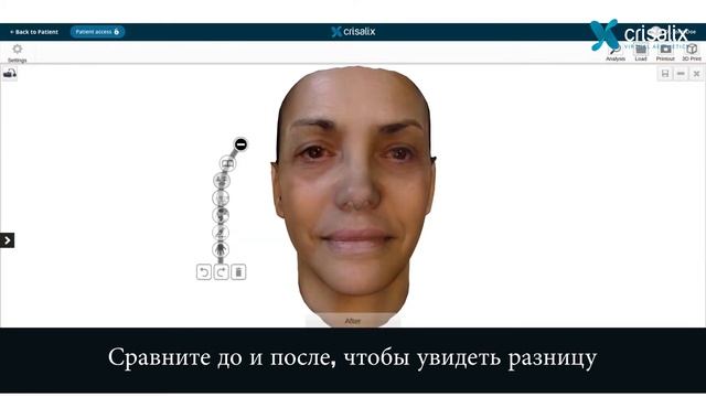 Crisalix - 3D моделирование лица смотреть онлайн