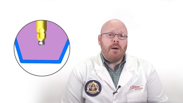 Implant impressions - Closed tray vs open tray смотреть онлайн