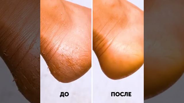 Что можно сделать с банановой кожурой? смотреть онлайн