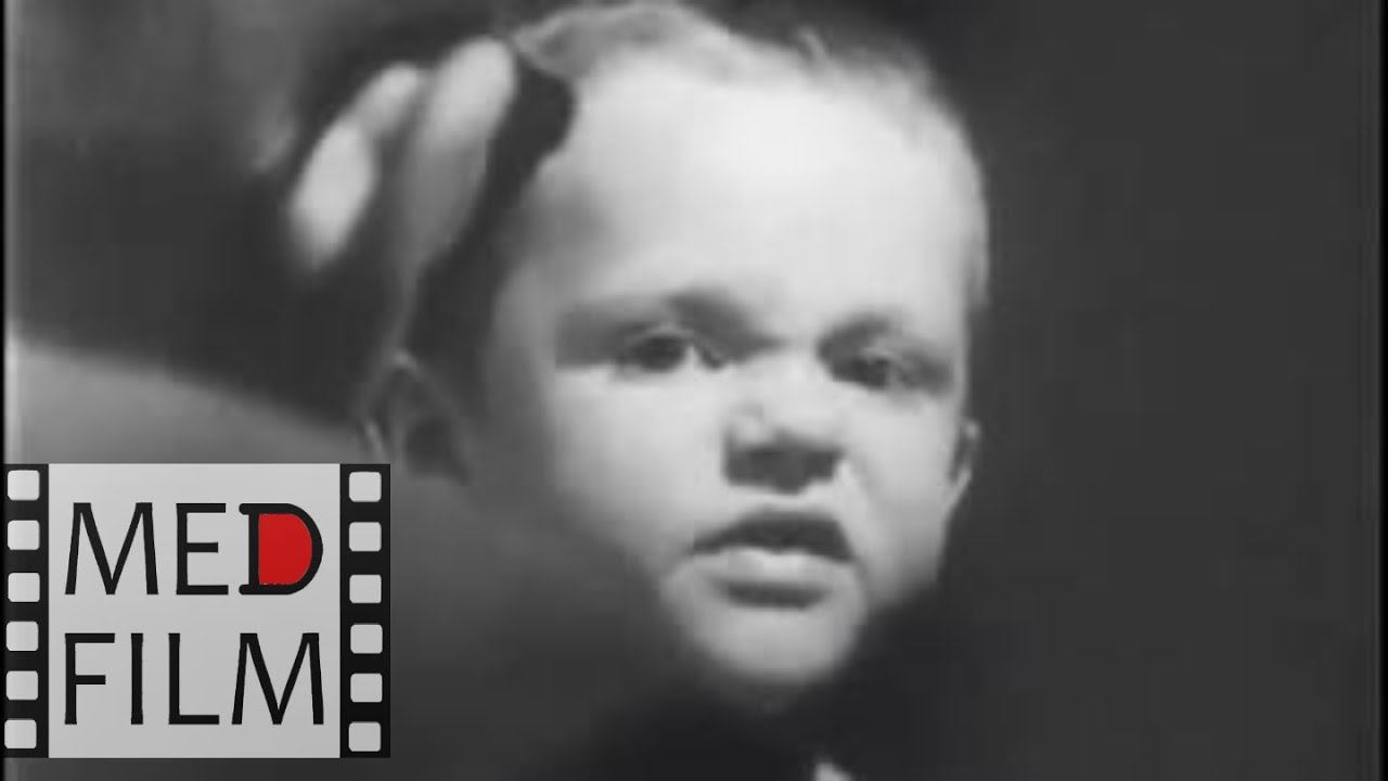 Autism. Child Psychiatry. Behaviour therapy © Аутизм у детей смотреть онлайн