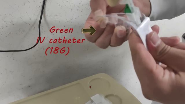 Remove Abdominal Fluid (ascites) | Paracentesis | Ascitic Fluid Aspiration