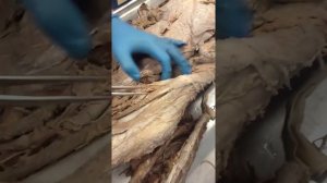 Артерии туловища и артерии нижней конечности