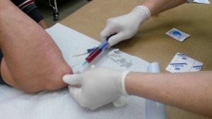 Лечение бурсита локтевого отростка