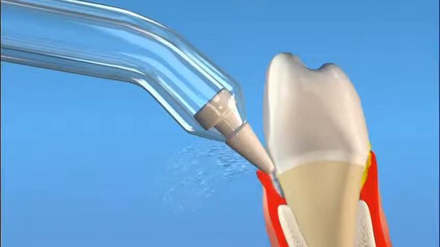 Чистка зубов с помощью ирригатора Waterpik смотреть онлайн