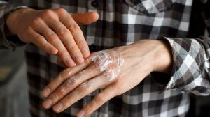 СИМПТОМЫ ПСОРИАЗА | Что такое псориаз и как его лечить