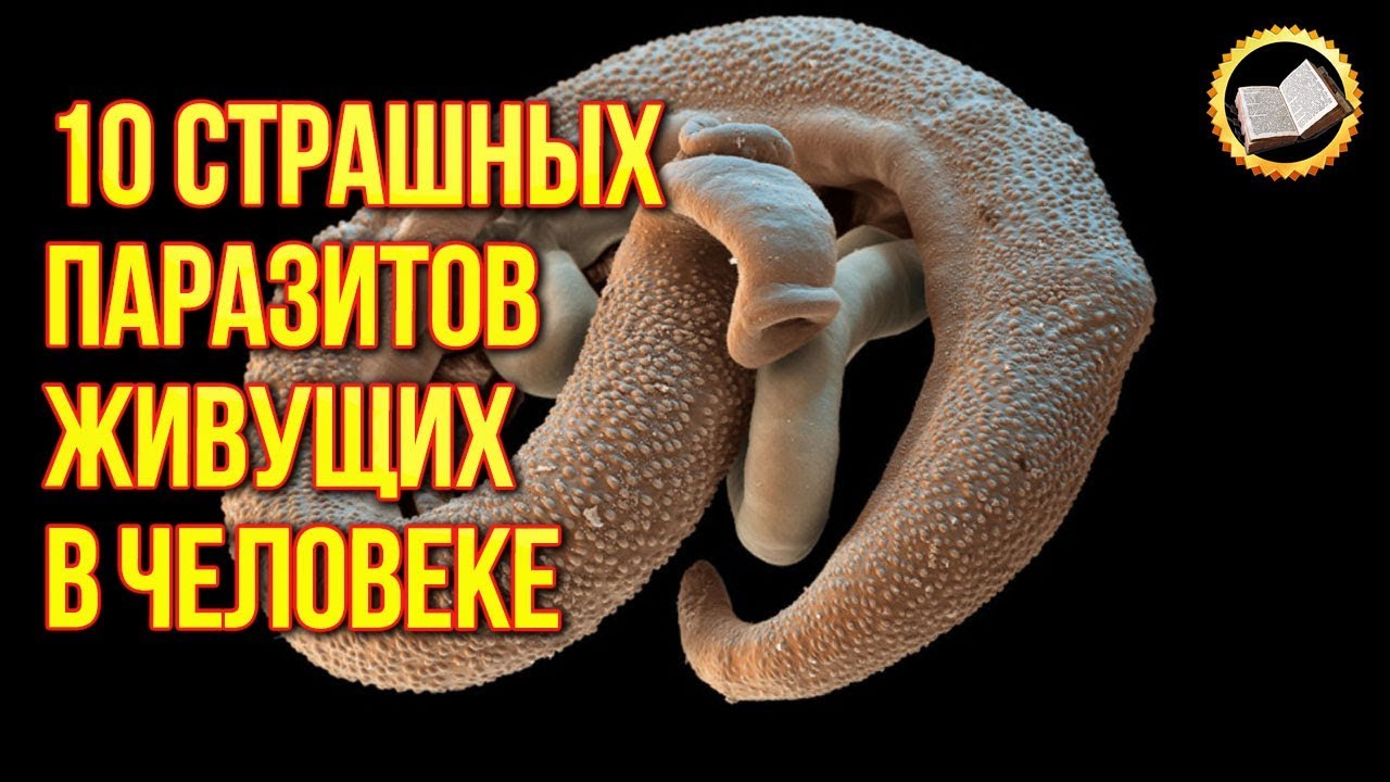 10 страшных паразитов живущих в человеке. Паразиты в человеческом организме смотреть онлайн