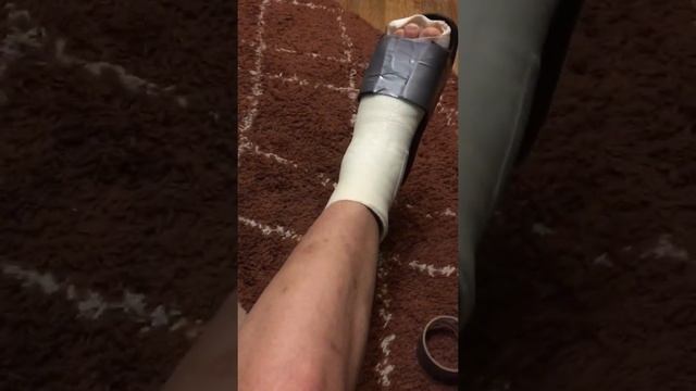 Обувь для того, что бы ходить в гипсе. Выдумка. смотреть онлайн
