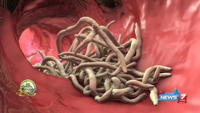 குடல் புழு நீக்க Tips | Home remedies for intestinal worms | kudal pulu neekam in tamil смотреть онлайн