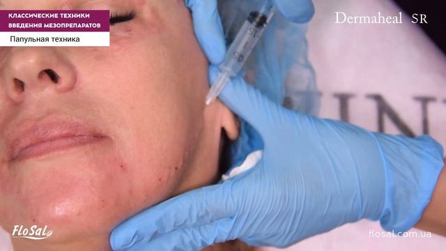 Классические техники введения мезопрепаратов - папульная методика и болюсы.Мезококтейль Dermaheal S