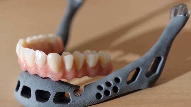 3D Printing Can Create Replacement Bones смотреть онлайн