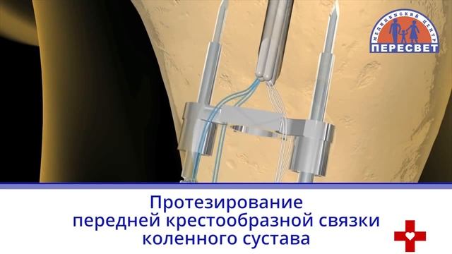 Врач травматолог-ортопед Назаретский Александр Александрович. смотреть онлайн