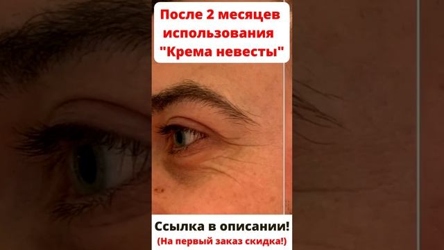 ?Лифтинг крем для лица! ? "Крем невесты" #омоложениелица #лифтинглица смотреть онлайн
