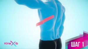 Kinexib - тейпирование при переломе ребра