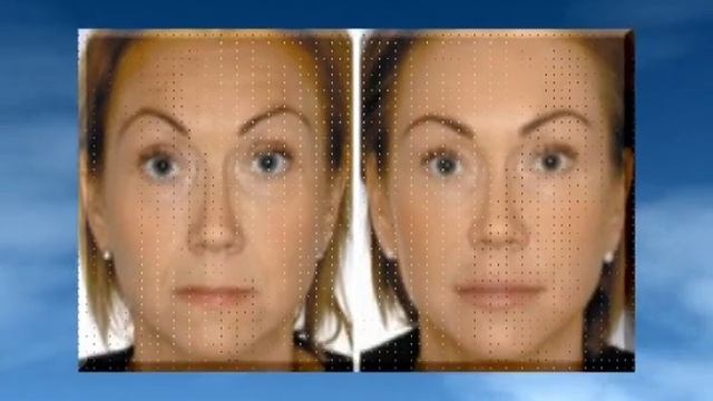 Контурная пластика рестилайн перлайн смотреть онлайн