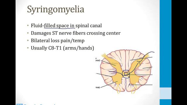 Neurology - 2. Nervous System Structures - 3.Spinal Cord Syndromes Atf