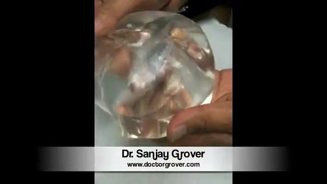 Slicing into silicone смотреть онлайн