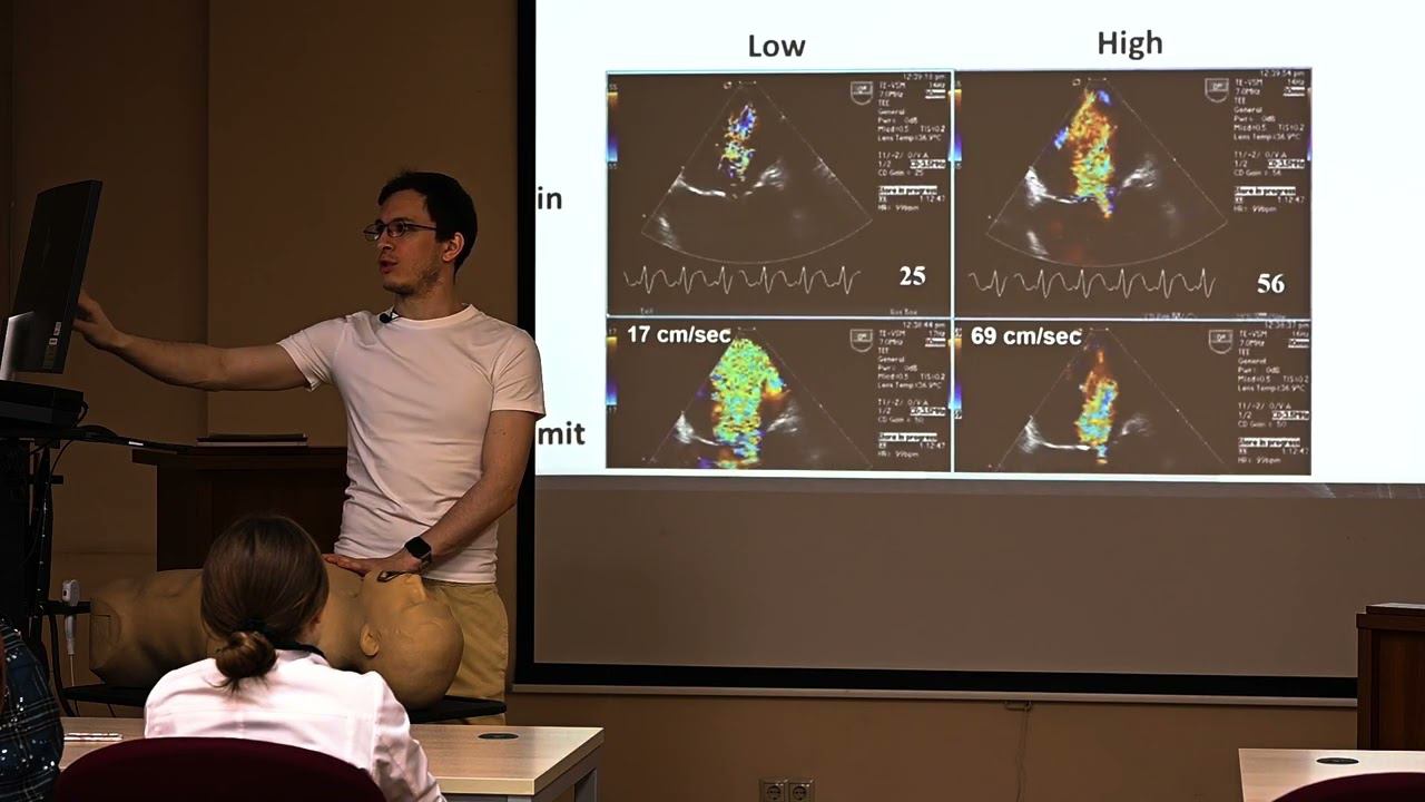 Эхокардиография. Занятие 13: Оценка регургитаций, часть 1: общие положения смотреть онлайн