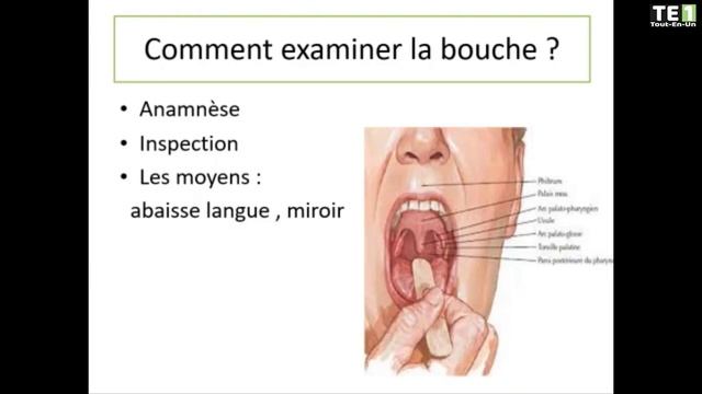 SEMIOLOGIE | 04- Examen de la bouche смотреть онлайн