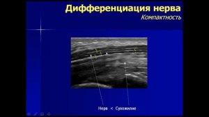 Основные приемы ультразвукового осмотра кисти. Просто о сложном. Малецкий Э.Ю.