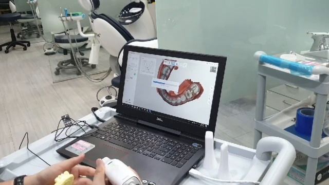 메디트 i500 구강 스캐너 2 (MEDIT i500 2019.Sep) смотреть онлайн