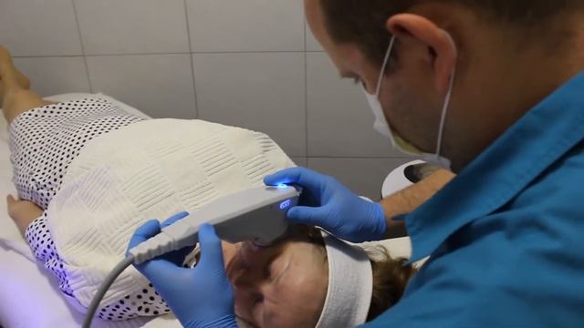 Postupak Ulthera - neinvazivni ultrazvučni SMAS lifting u Vita Elos-u