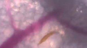 Как комар пьёт кровь