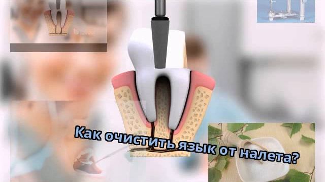 Как очистить язык от налета? смотреть онлайн
