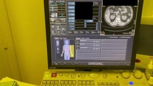 Укладка локтевого сустава для компьютерной томографии