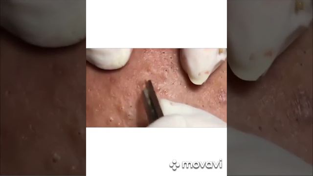 смачный прыщ смотреть онлайн