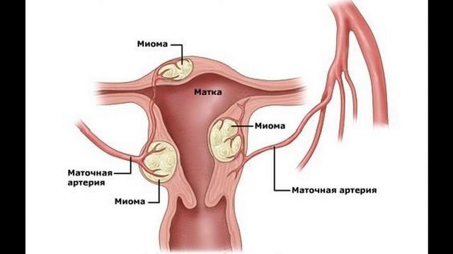 Какие бывают виды опухолей? (подкаст) смотреть онлайн
