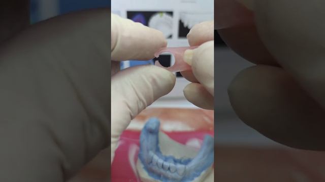 протез из термопласта смотреть онлайн