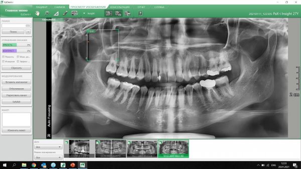 Smart Plus with Insight Pan