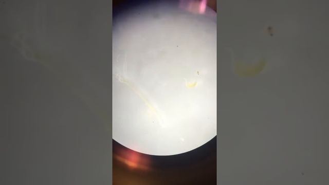 Hydra (No consumption of Daphnia) смотреть онлайн