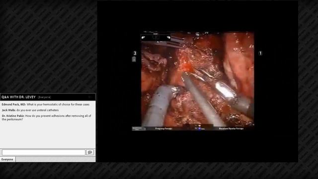 Dr. Levey Presents a Webinar on Robotic Management of Endometriosis Associated with Pelvic Pain смотреть онлайн