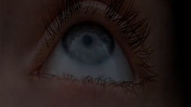 Почему выпадают ресницы смотреть онлайн