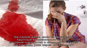 Что делать, если идет кровь из носа часто?