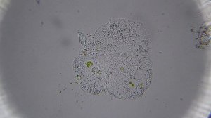 Микробы под микроскопом