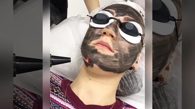 Студия лазерной эпиляции IpLaser смотреть онлайн