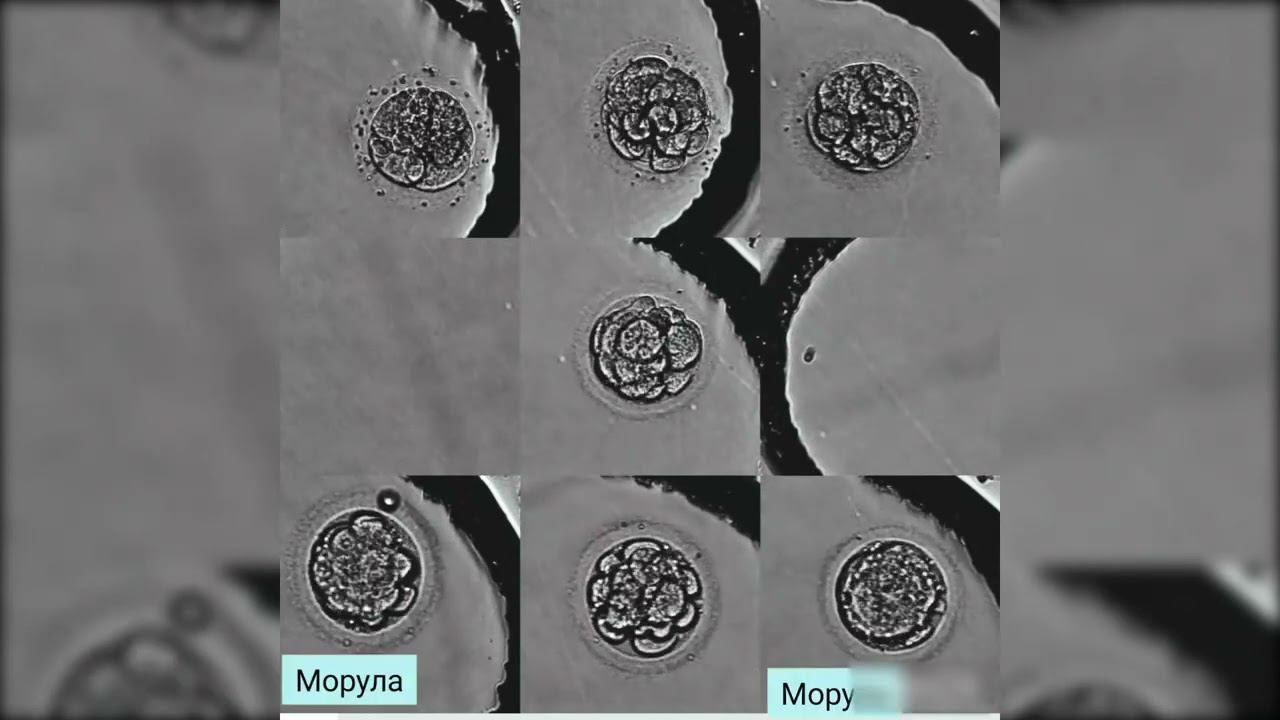 Primo Vision смотреть онлайн
