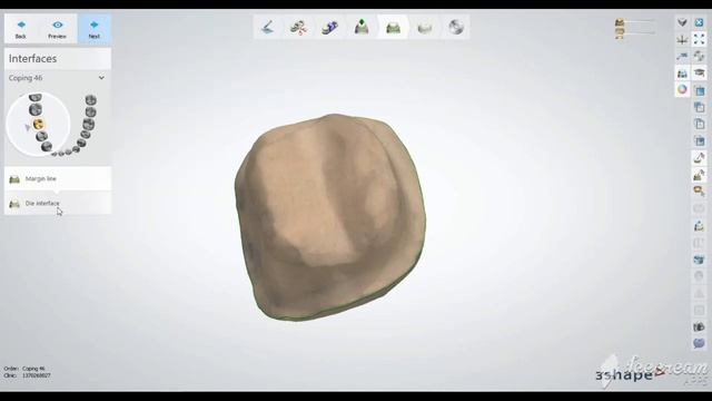 3shape crown design أ.أسامة حجاوي смотреть онлайн